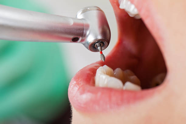 Best Pediatric Emergency Dentist in Cheswick, PA